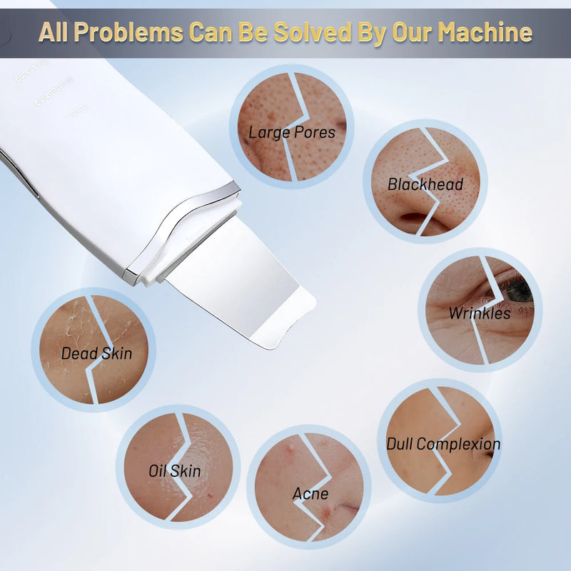 UltraSkin Pro™ – Limpeza Profunda Ultrassônica